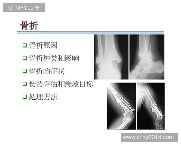 足球明星频繁骨折的原因探讨与运动伤害的深层次分析
